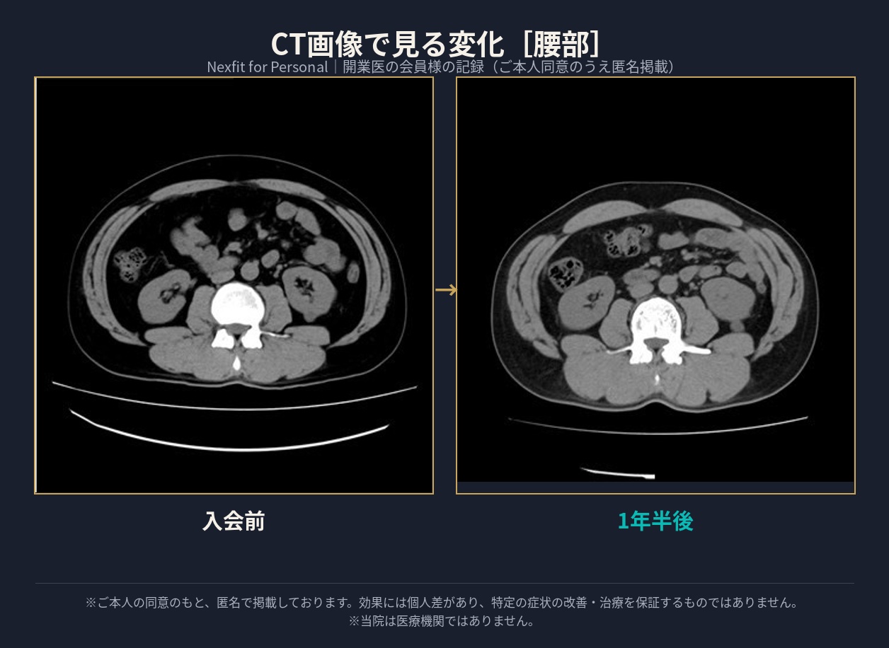 CT画像比較（腰部）入会前と1年半後の筋肉量の変化